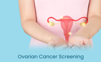 Ovarian Cancer Screening Tests for Early Detection and Diagnosis