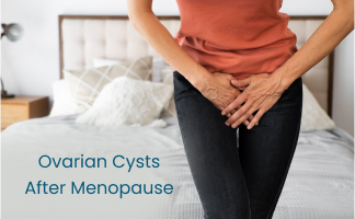 Ovarian Cysts After Menopause: Causes and Symptoms