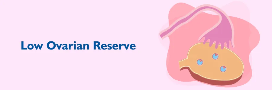 Ovarian Reserve Getting Pregnant With Low Ovarian Reserve