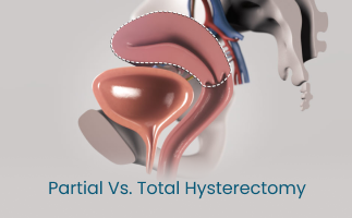 Partial vs Total Hysterectomy Understanding the Key Differences