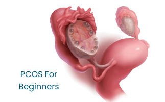 PCOS Polycystic Ovarian Syndrome Basics for Beginners