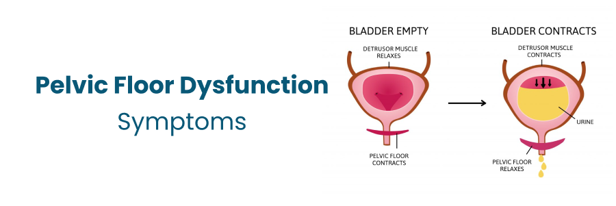 Pelvic Floor Dysfunction