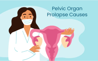 Pelvic Organ Prolapse Causes Symptoms Risk Factors