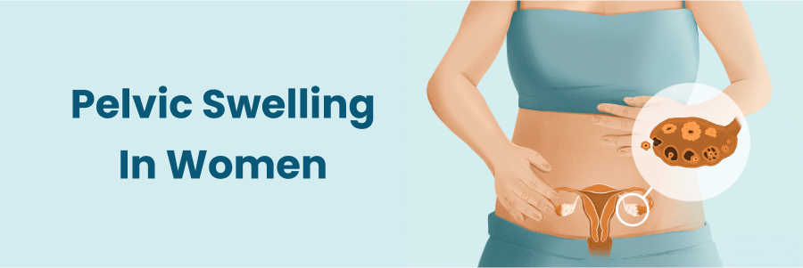 Pelvic Swelling in Women When to Seek Medical Attention