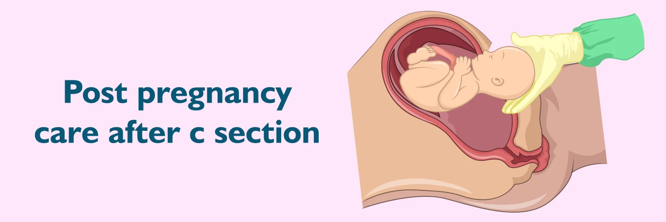 Post pregnancy care after c section