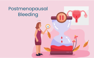 Postmenopausal Bleeding and Common Causes and Symptoms