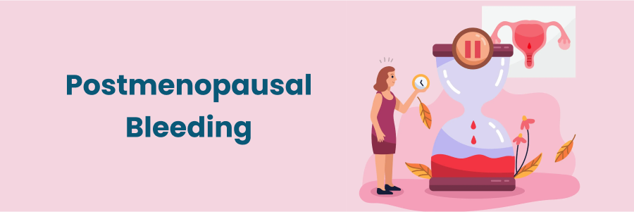 Postmenopausal Bleeding