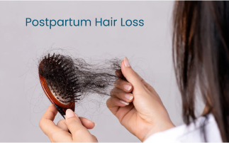 Causes  Coping Strategies for Postpartum Hair Loss