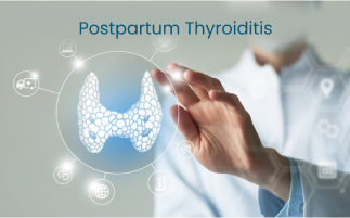 Postpartum Thyroiditis Diagnosis Tips and Treatment