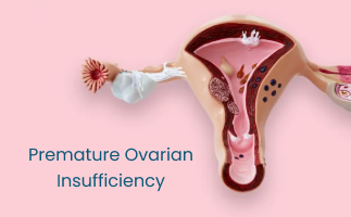 Premature Ovarian Insufficiency and Early Menopause