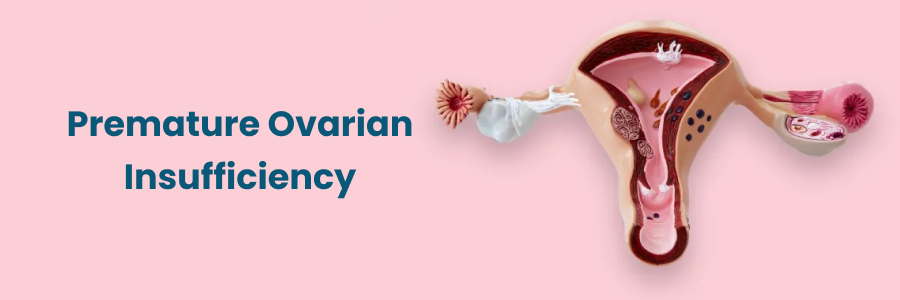 Premature Ovarian Insufficiency