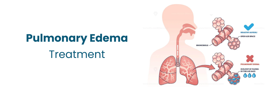 Pulmonary Edema Treatment