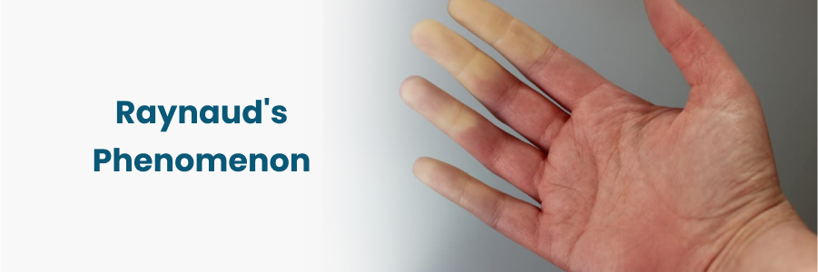 Raynaud'S Phenomenon