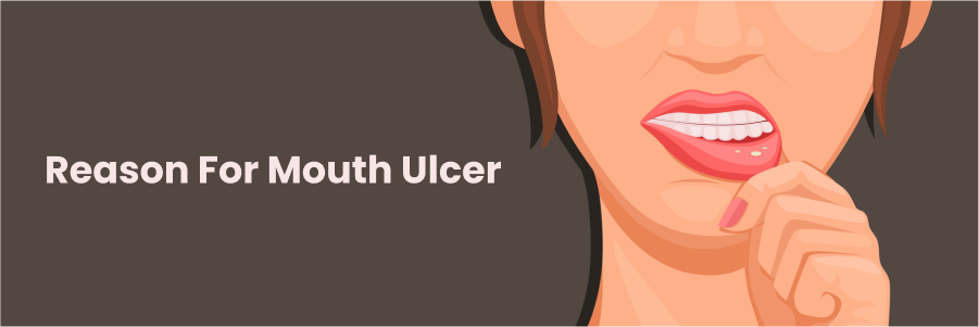 Reason for Mouth Ulcer