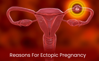 Complete Guide on Reasons For Ectopic Pregnancy