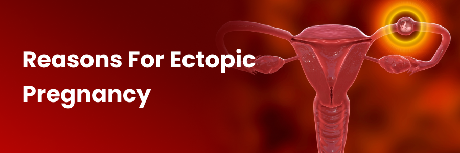 Reasons For Ectopic Pregnancy