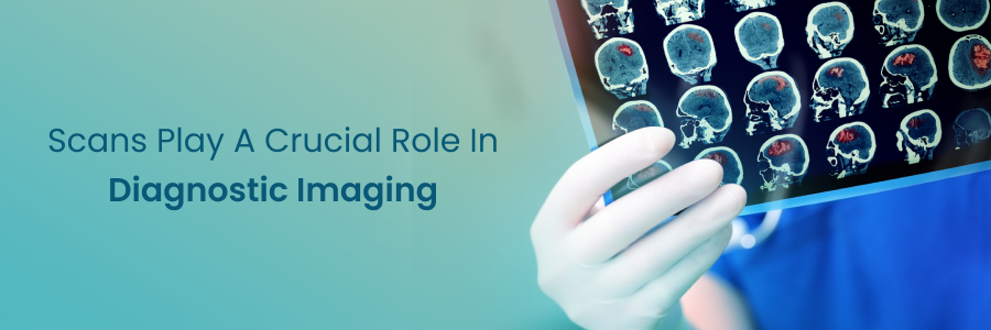 How Scans Play a Crucial Role in Diagnostic Imaging