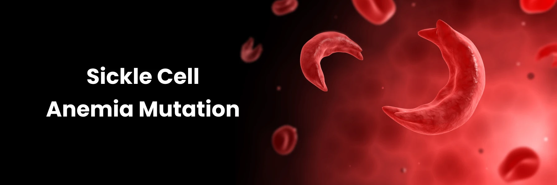 Sickle Cell Anemia Mutation