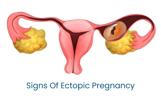 Understand The Signs and Warnings of Ectopic Pregnancy