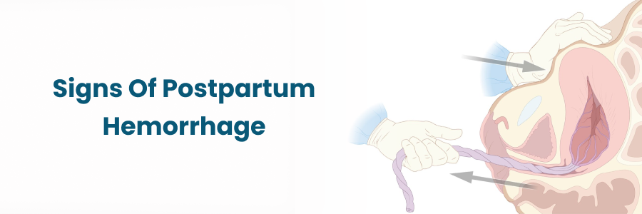 Signs of Postpartum Hemorrhage