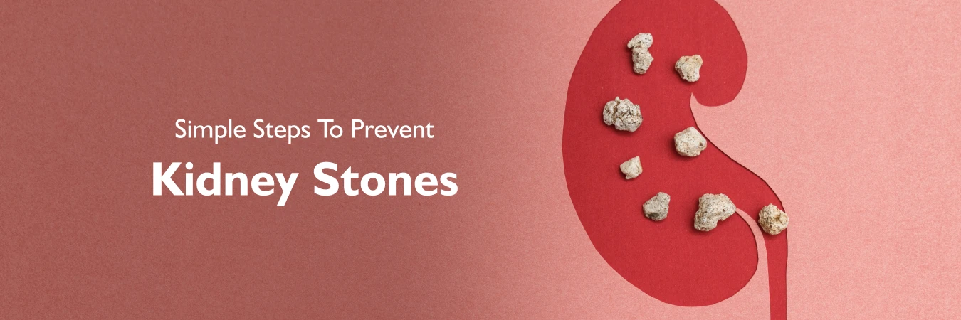 5 Simple Steps To Prevent Kidney Stones