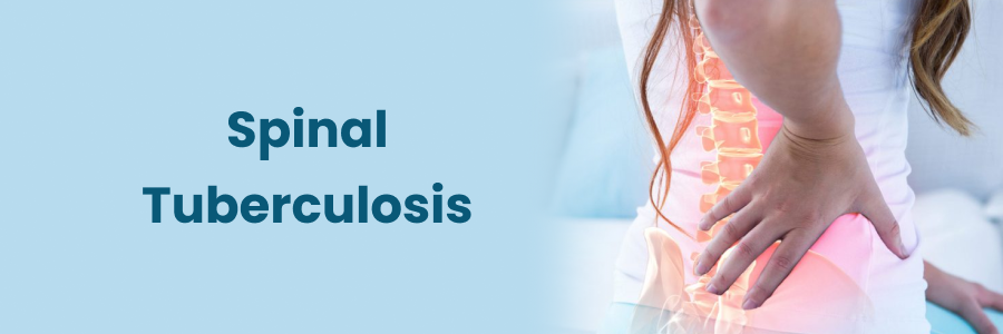 Spinal Tuberculosis symptoms, treatment and Diagnosis