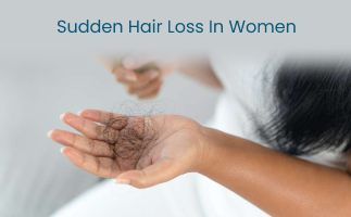 Causes of Sudden Hair Loss in Women Hormonal or More