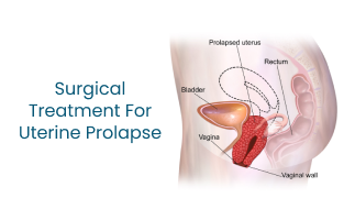 Surgical Treatment for Uterine Prolapse  Medicover Hospital