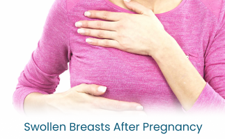 What Causes Swollen Breasts After Pregnancy