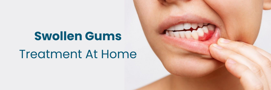 Swollen Gums Treatment At Home