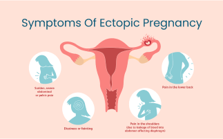 Early Signs and Symptoms of Ectopic Pregnancy and Treatment