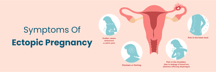 Symptoms Of Ectopic Pregnancy