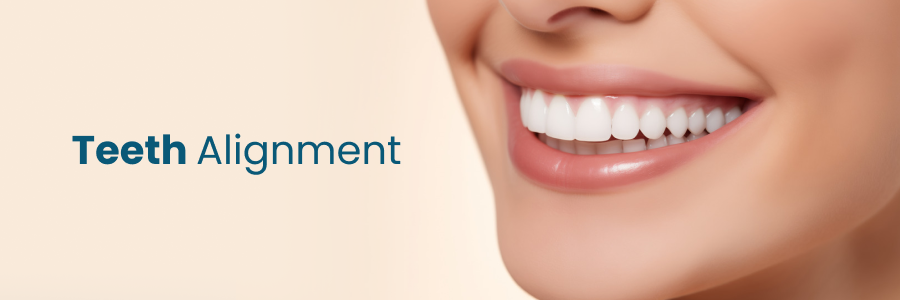 Teeth Alignment