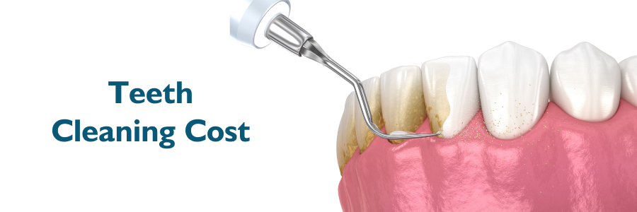 Factors Affecting Teeth Cleaning Costs