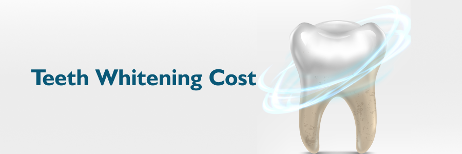 Teeth Whitening Cost