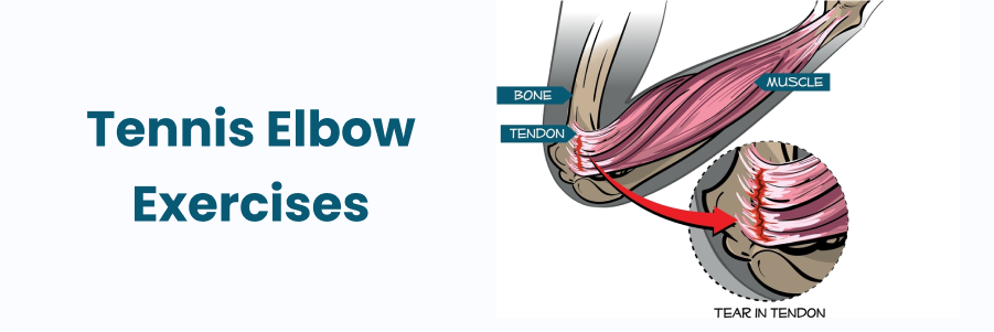 tennis elbow exercises