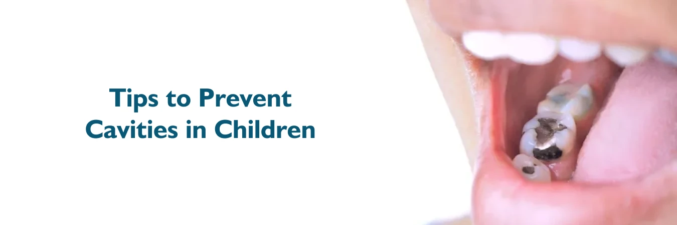 Tips to Prevent Cavities in Children