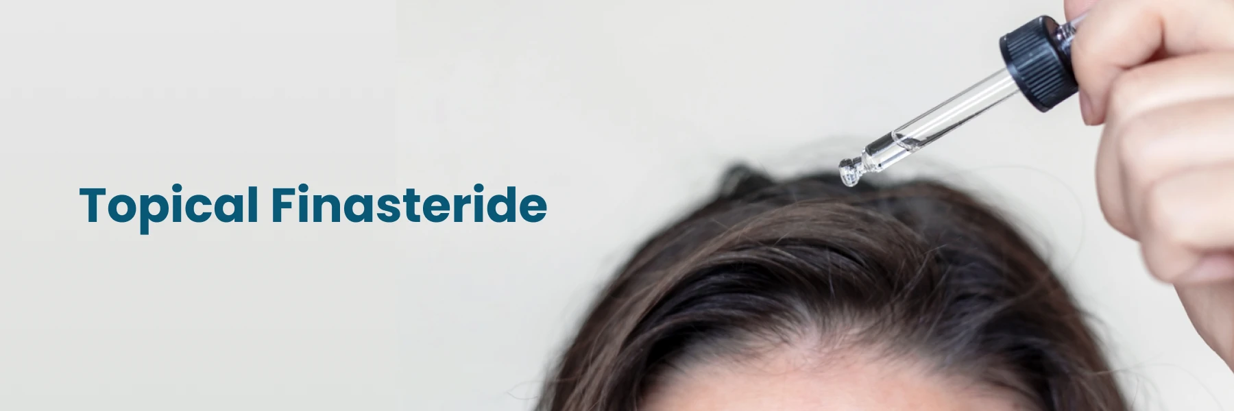 Topical finasteride