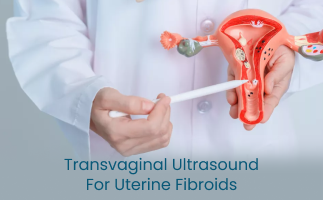 Transvaginal Ultrasound A Key Tool for Diagnosing Uterine Fibroids