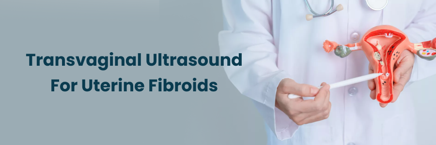 Transvaginal Ultrasound For Uterine Fibroids