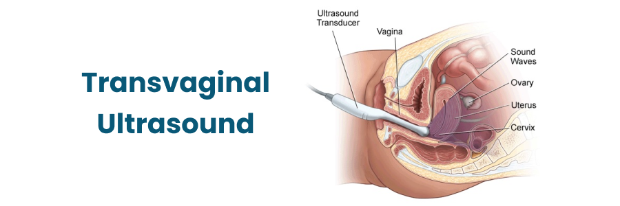 Transvaginal Ultrasound