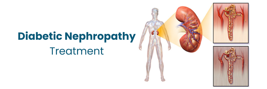 Treatment Options for Diabetic Nephropathy

