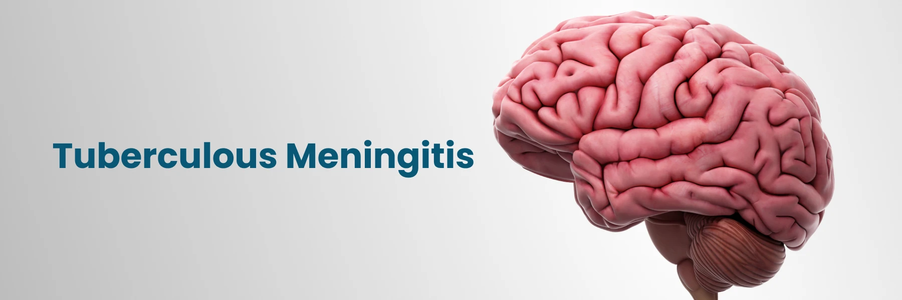 Tuberculous Meningitis