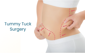 Achieve a Flatter Abdomen with Tummy Tuck Surgery