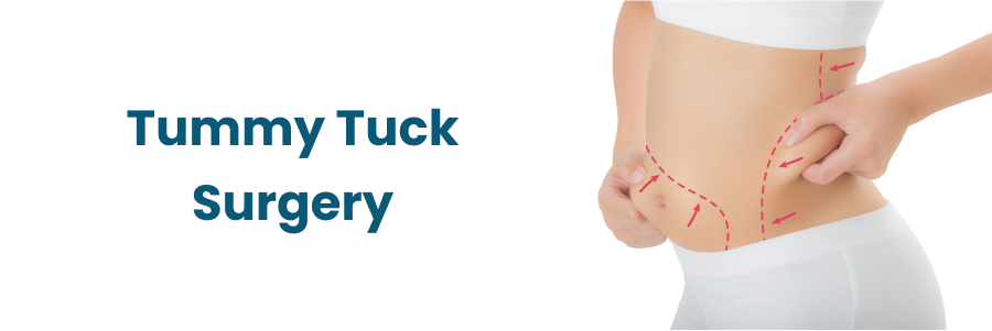 Tummy Tuck Surgery