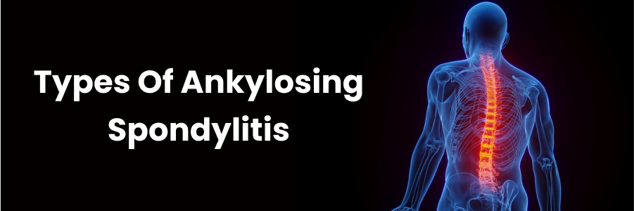 Types Of Ankylosing Spondylitis