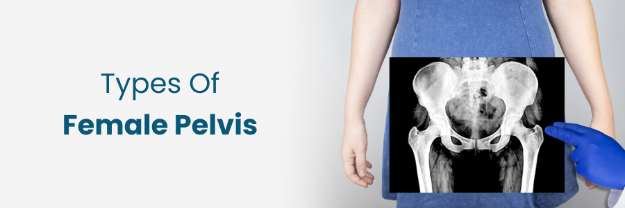 Types Of Female Pelvis