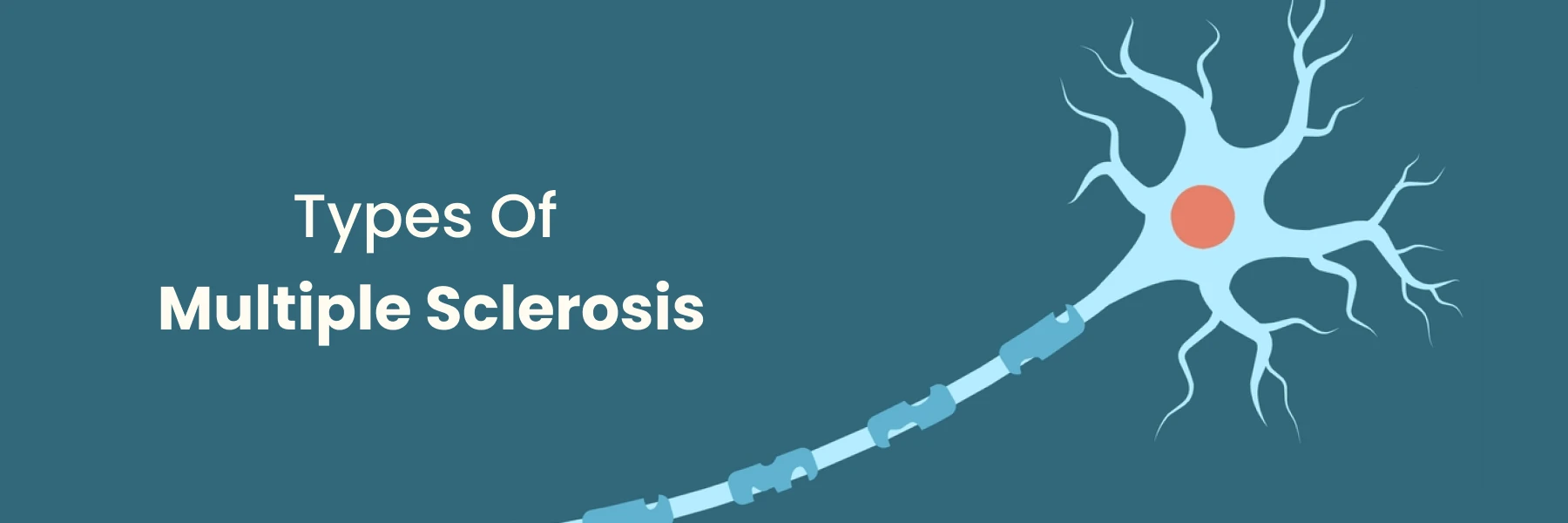 Types of Multiple Sclerosis Understanding Types and Characteristics