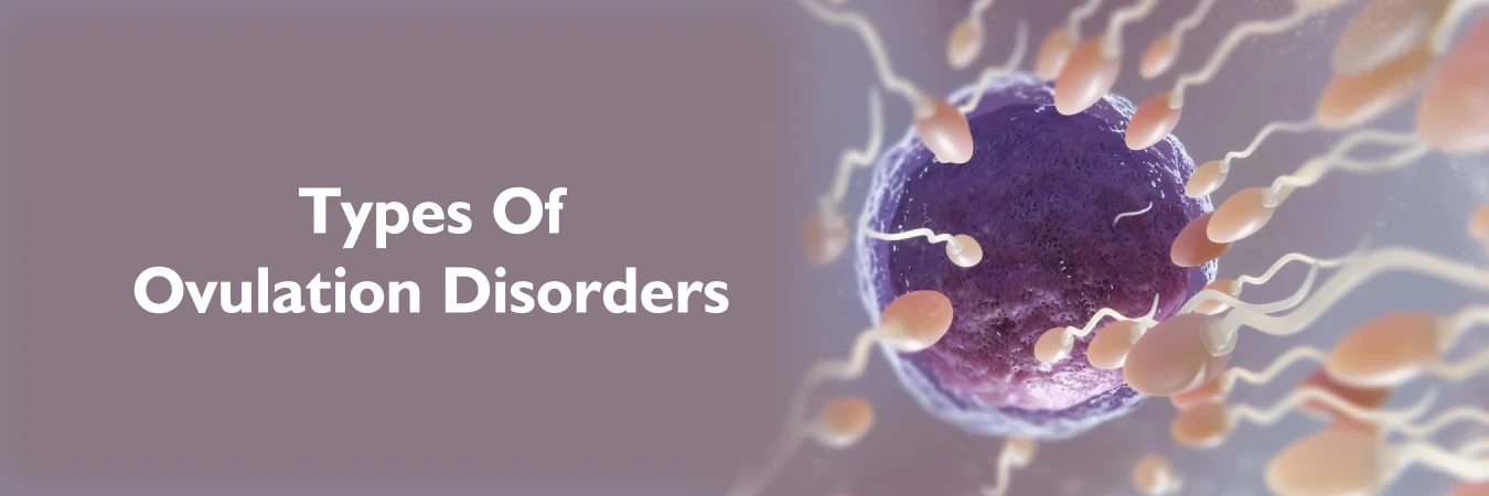 Types Of Ovulation Disorders