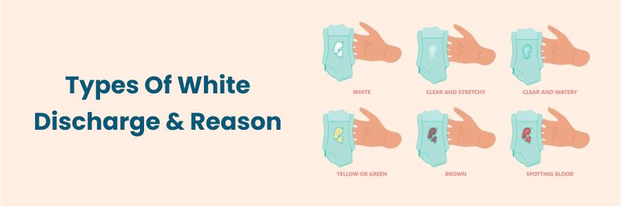 Types Of White Discharge And Reason